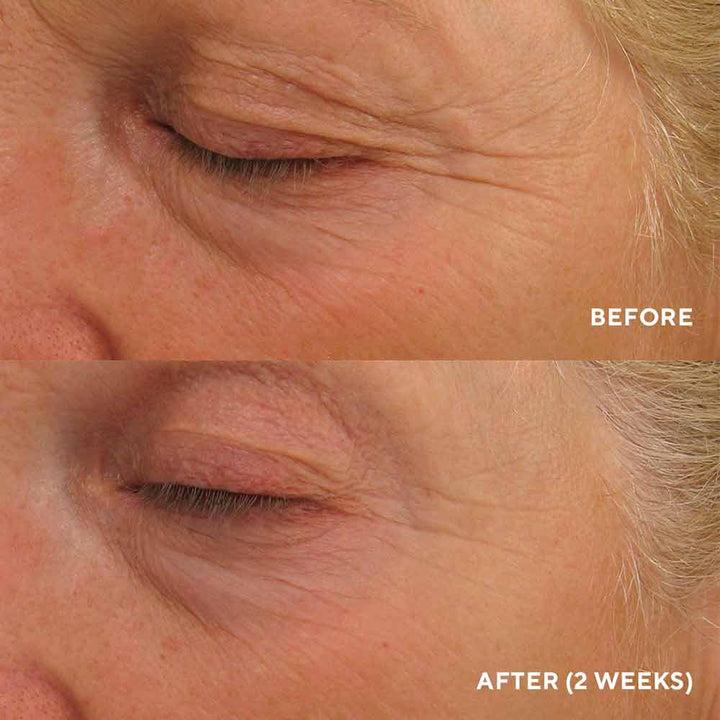 Інтенсивний ліфтинг-крем для повік HydroPeptide Eye Authority 15 мл, фото 3