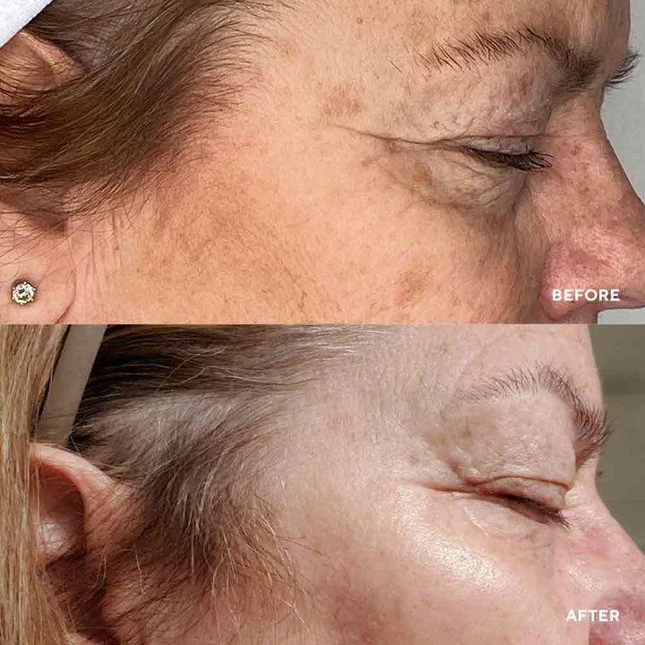 Сироватка з миттєвою anti-age дією HydroPeptide Vital Eyes 15 мл, фото 2