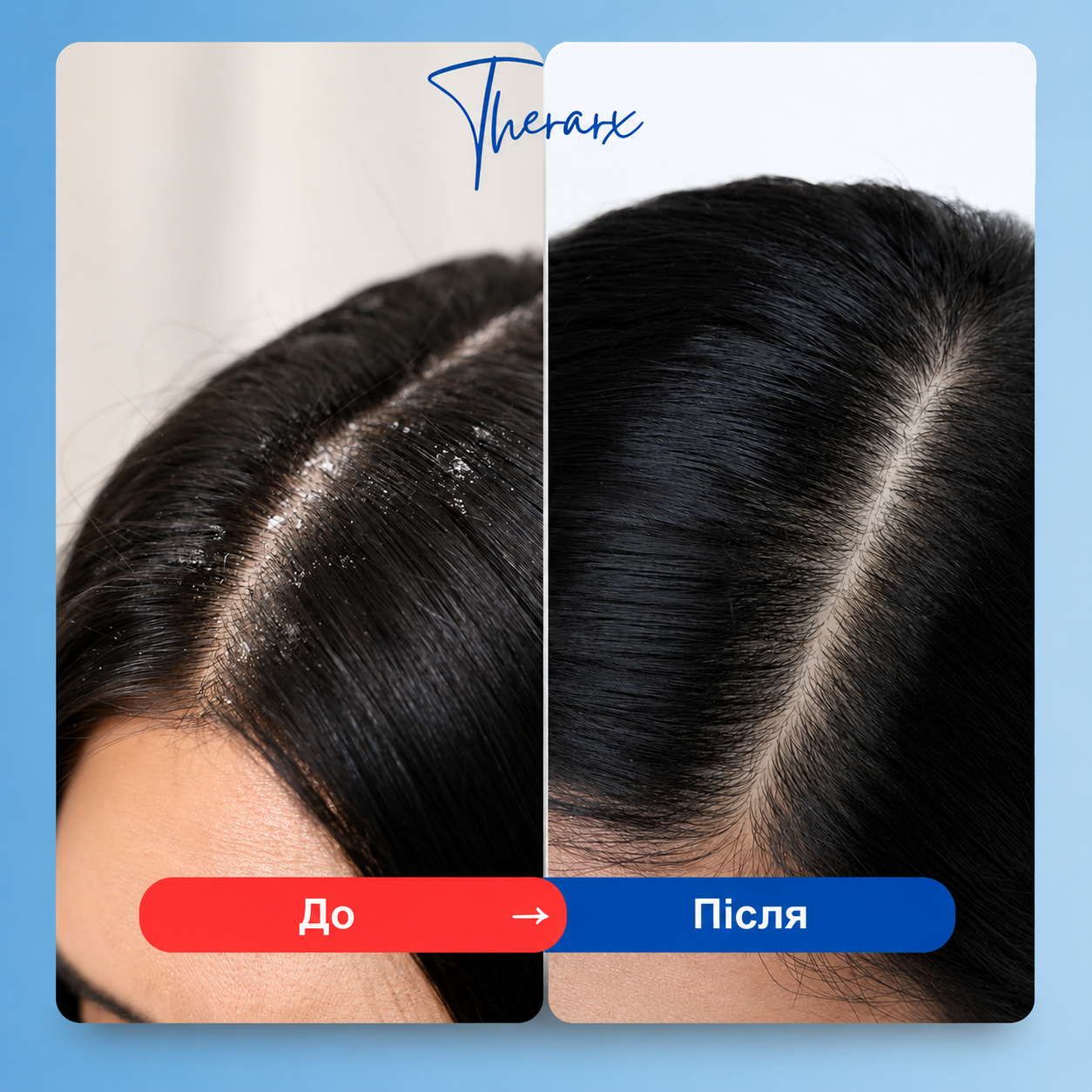 Очищуючий, протизапальний догляд Mediceuticals TheraRX™ 250ml, фото 2