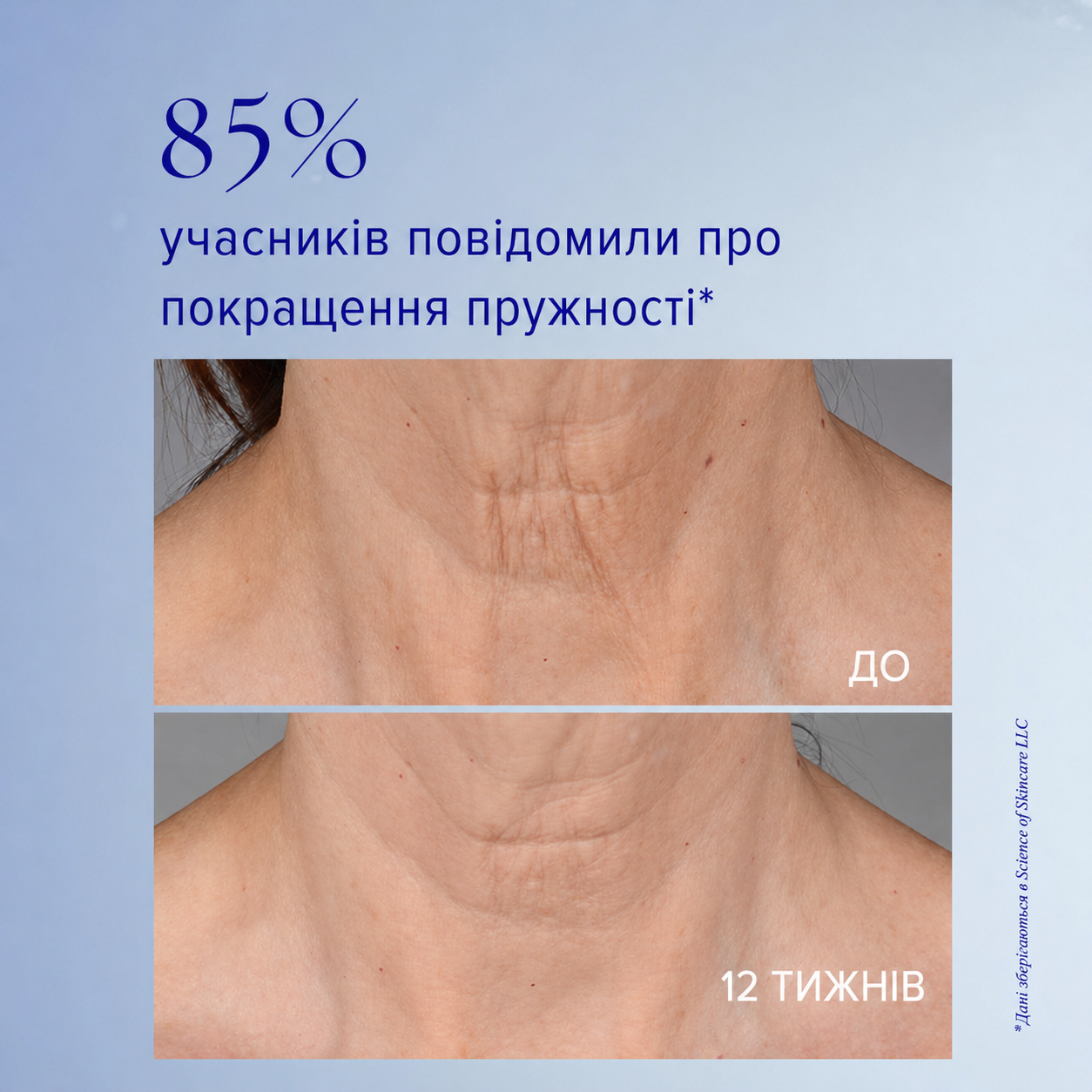 Крем для шиї та декольте Is Clinical NeckPerfect Complex 50 мл, фото 6