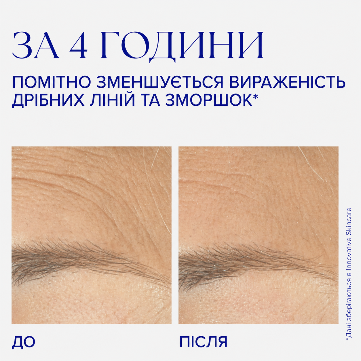 Крем омолоджуючий для обличчя Is Clinical Youth Complex, 30 г, фото 5