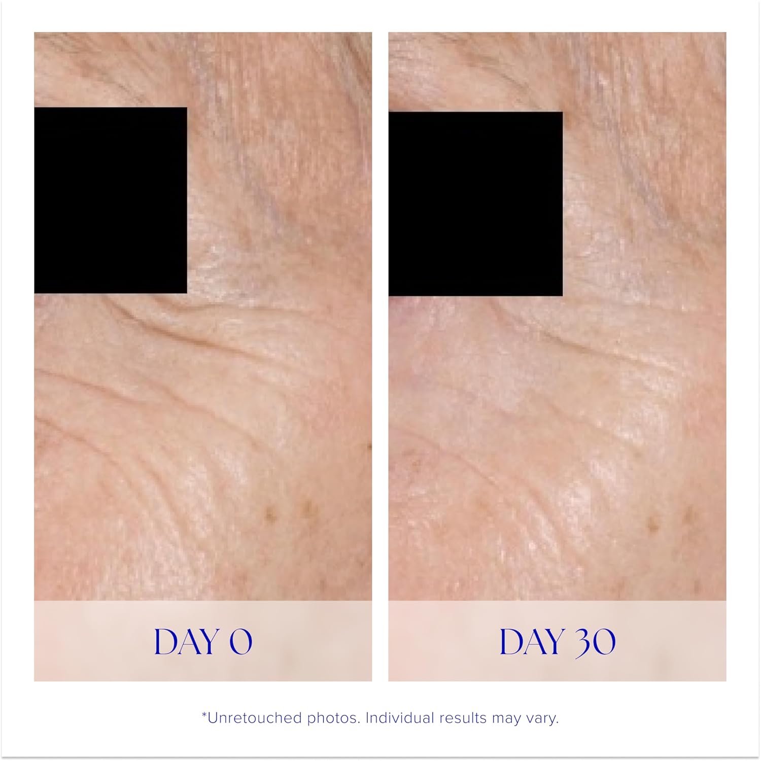 Крем для шкіри навколо очей IS Clinical Eye Complex 15ml, фото 3